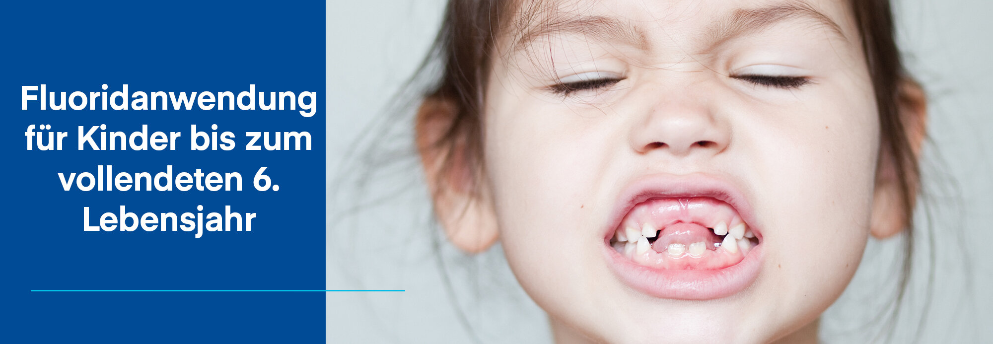 Nahaufnahme Mädchen zeigt Zähne mit vielen Zahnlücken, daneben blauer Hintergrund mit Aufschrift Fluoridanwendung für Kinder bis zum vollendeten 6. Lebensjahr