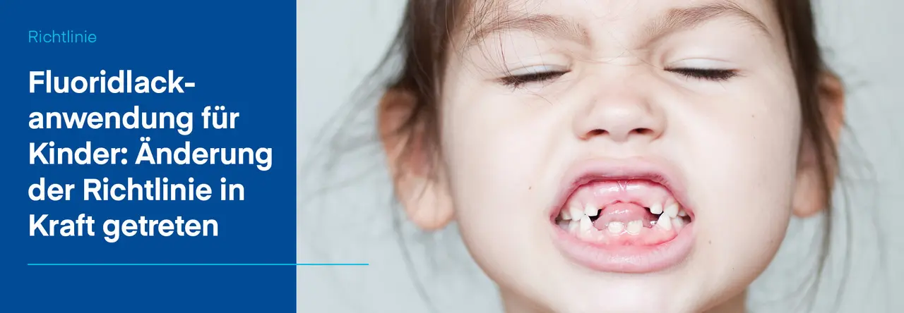 Nahaufnahme Mädchen zeigt Zähne mit vielen Zahnlücken, daneben blauer Hintergrund mit Aufschrift Fluoridlackanwendung für Kinder: Änderung der Richtlinie in Kraft getreten